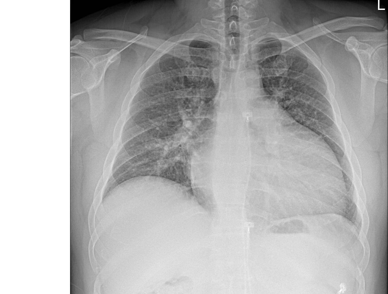 30/M, dyspnea