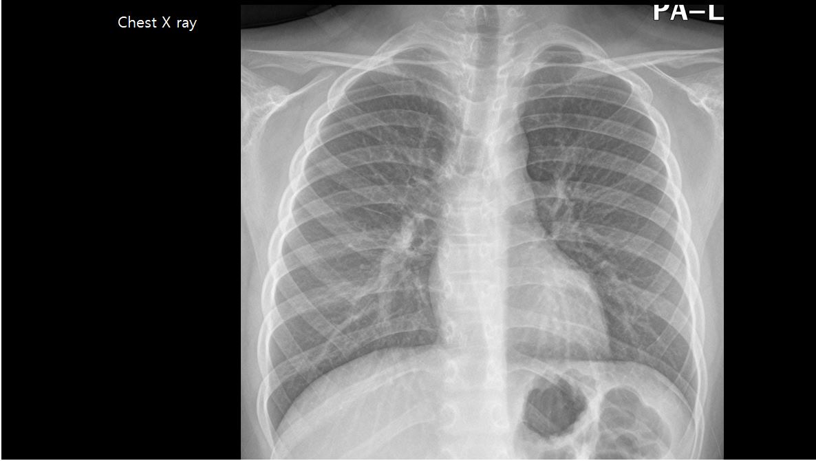 10/F, tachycardia