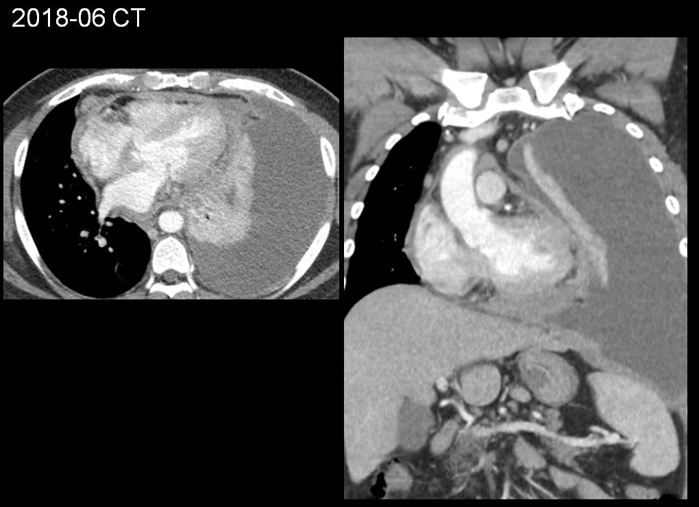 35/M, dyspnea (2MA) chest pain (2DA)
