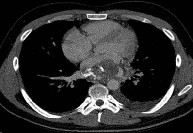 21/M, chest pain (8HA)