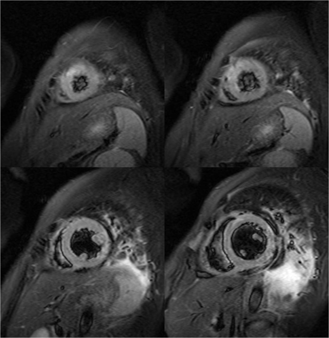 M/32, Epigastric pain (3days ago)