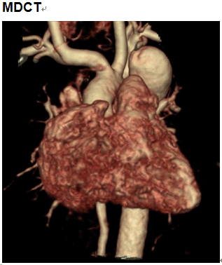 M/ newborn, C.C.: Fetal echocardiographic abnormality