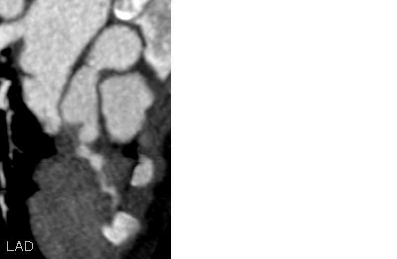 M/2 C.C. : Fever and skin rash