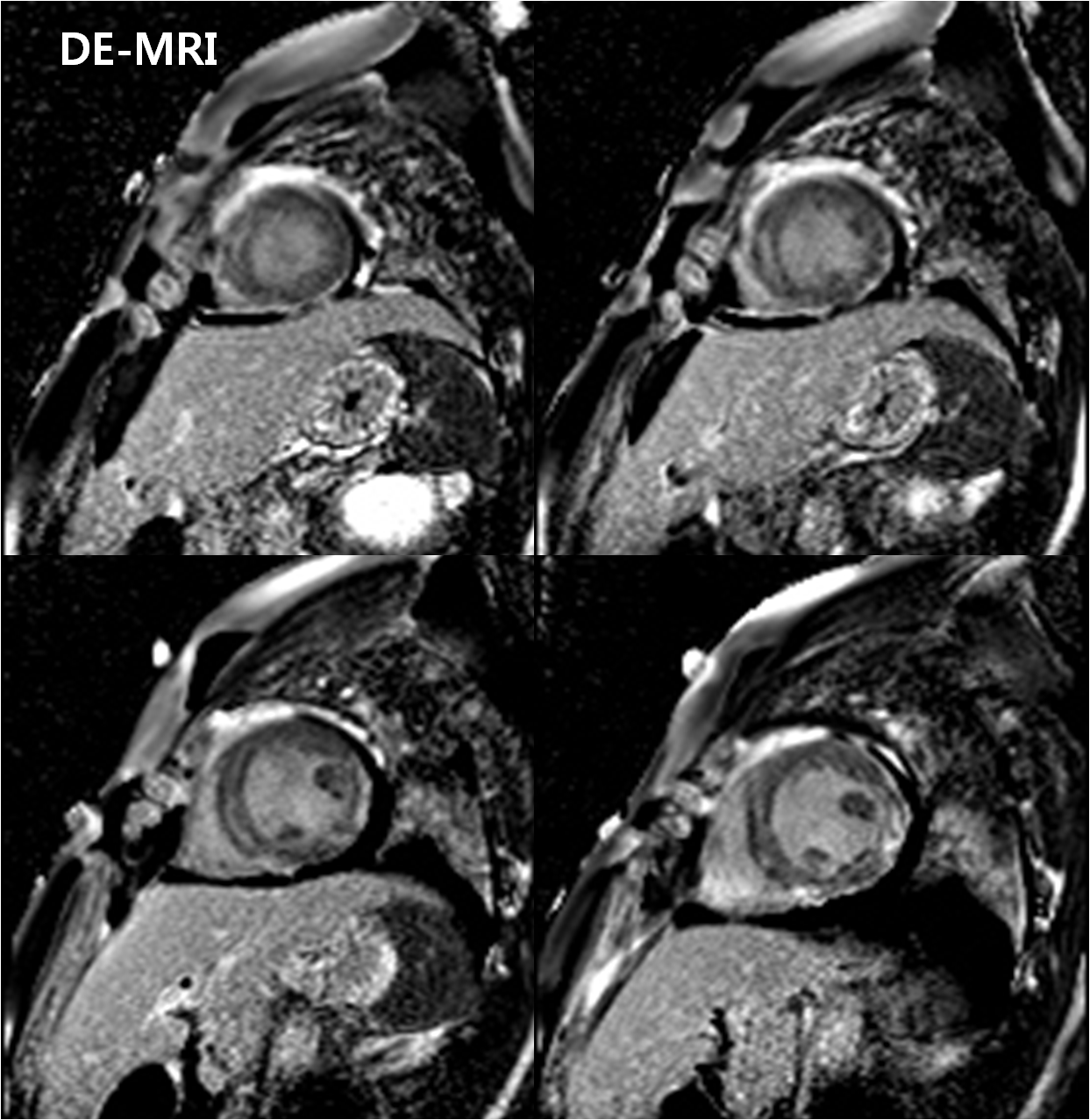 M/32, Epigastric pain (3days ago)